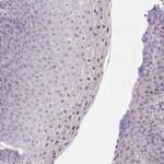 RNF169 Polyclonal Antibody