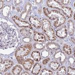 C12orf43 Antibody in Immunohistochemistry (Paraffin) (IHC (P))