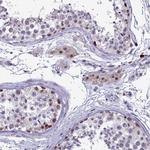 POM121L2 Polyclonal Antibody