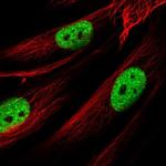 AMIGO1 Polyclonal Antibody