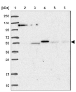 AMIGO1 Antibody in Western Blot (WB)