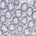 AMN1 Antibody in Immunohistochemistry (Paraffin) (IHC (P))