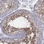 AMN1 Antibody in Immunohistochemistry (Paraffin) (IHC (P))