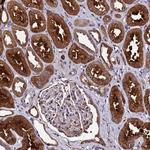 GSTCD Antibody in Immunohistochemistry (Paraffin) (IHC (P))