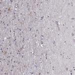 LUZP2 Antibody in Immunohistochemistry (IHC)