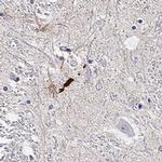 LUZP2 Antibody in Immunohistochemistry (IHC)