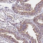 LRRIQ1 Antibody in Immunohistochemistry (Paraffin) (IHC (P))