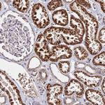 LRRIQ1 Antibody in Immunohistochemistry (Paraffin) (IHC (P))