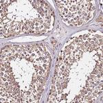 LRRIQ1 Antibody in Immunohistochemistry (Paraffin) (IHC (P))