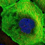 MMTAG2 Polyclonal Antibody