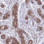 MMTAG2 Antibody in Immunohistochemistry (Paraffin) (IHC (P))