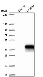 MMTAG2 Antibody in Western Blot (WB)