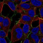 STARD4 Polyclonal Antibody