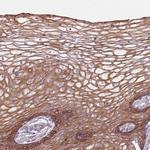 HSPA14 Polyclonal Antibody