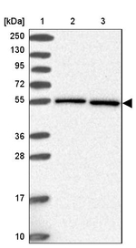 HSPA14 Antibody in Western Blot (WB)
