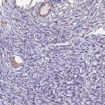 JRKL Polyclonal Antibody