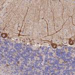 GDAP2 Antibody in Immunohistochemistry (IHC)