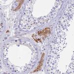 GDAP2 Antibody in Immunohistochemistry (IHC)