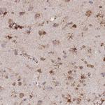 GDAP2 Antibody in Immunohistochemistry (IHC)