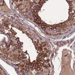 MAB21L3 Polyclonal Antibody