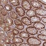 FOXRED1 Polyclonal Antibody