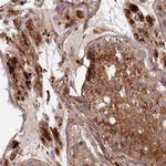 C2CD5 Antibody in Immunohistochemistry (Paraffin) (IHC (P))