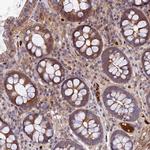 WIBG Antibody in Immunohistochemistry (Paraffin) (IHC (P))