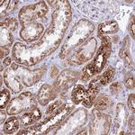 PNLIPRP3 Polyclonal Antibody