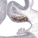 SKOR2 Polyclonal Antibody