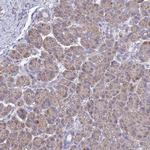 EFCAB4A Polyclonal Antibody