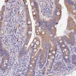 PRR13 Polyclonal Antibody