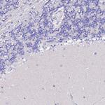 TMEM117 Antibody in Immunohistochemistry (Paraffin) (IHC (P))