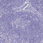 TMEM117 Antibody in Immunohistochemistry (Paraffin) (IHC (P))