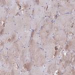 TMEM117 Antibody in Immunohistochemistry (Paraffin) (IHC (P))