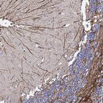 SYT13 Antibody in Immunohistochemistry (Paraffin) (IHC (P))