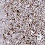 SYT13 Polyclonal Antibody