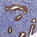 SYT13 Antibody in Immunohistochemistry (Paraffin) (IHC (P))