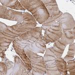 SYT13 Antibody in Immunohistochemistry (Paraffin) (IHC (P))