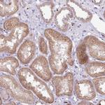 PLEKHH3 Antibody in Immunohistochemistry (Paraffin) (IHC (P))