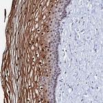MTCL1 Antibody in Immunohistochemistry (Paraffin) (IHC (P))