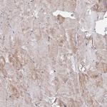 MTCL1 Antibody in Immunohistochemistry (Paraffin) (IHC (P))