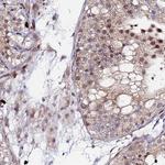 MTCL1 Antibody in Immunohistochemistry (Paraffin) (IHC (P))