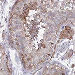 SCAPER Polyclonal Antibody