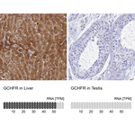 GCHFR Antibody in Immunohistochemistry (Paraffin) (IHC (P))