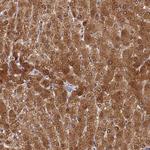 GCHFR Antibody in Immunohistochemistry (Paraffin) (IHC (P))