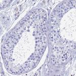 GCHFR Antibody in Immunohistochemistry (Paraffin) (IHC (P))