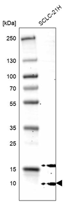 GCHFR Antibody in Western Blot (WB)