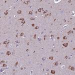 FAM173A Antibody in Immunohistochemistry (Paraffin) (IHC (P))