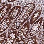 TSR3 Polyclonal Antibody