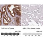 ALDH1A3 Antibody